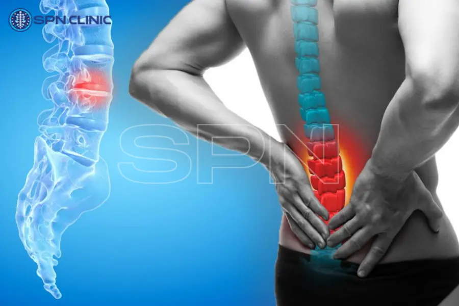 ameliyatsız bel fıtığı tedavisi fiyatları