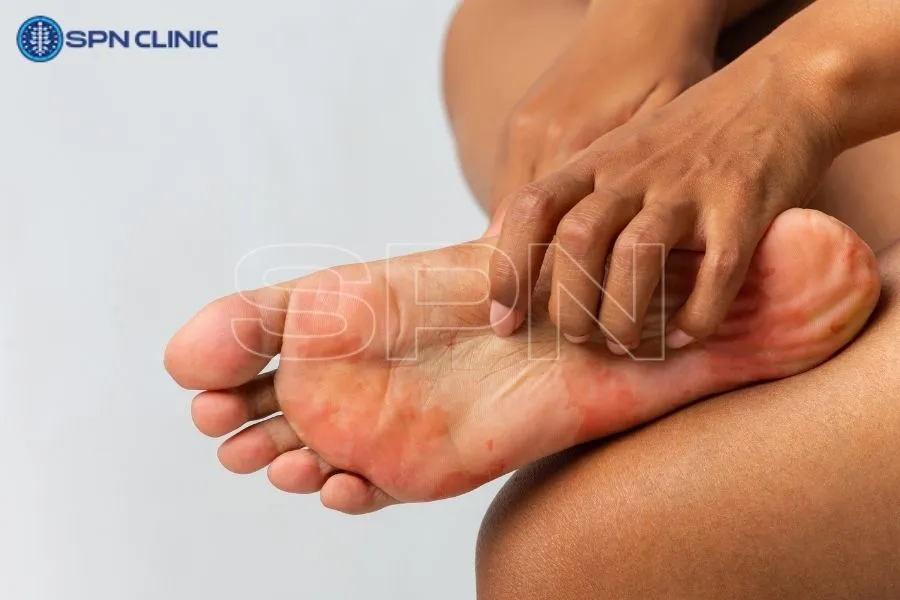 ayakta kireçlenme neden olur